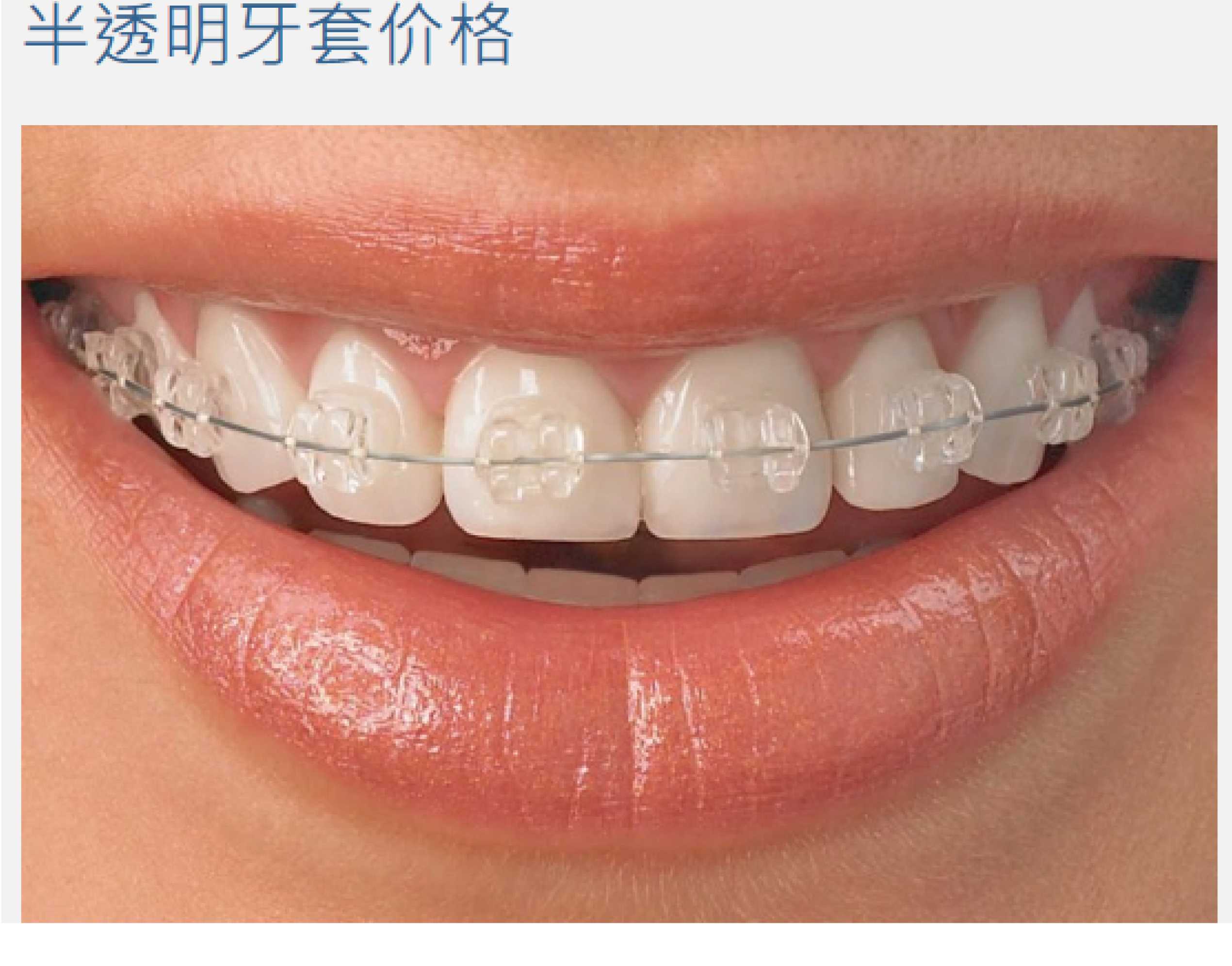 照片21_画板 1.jpg 