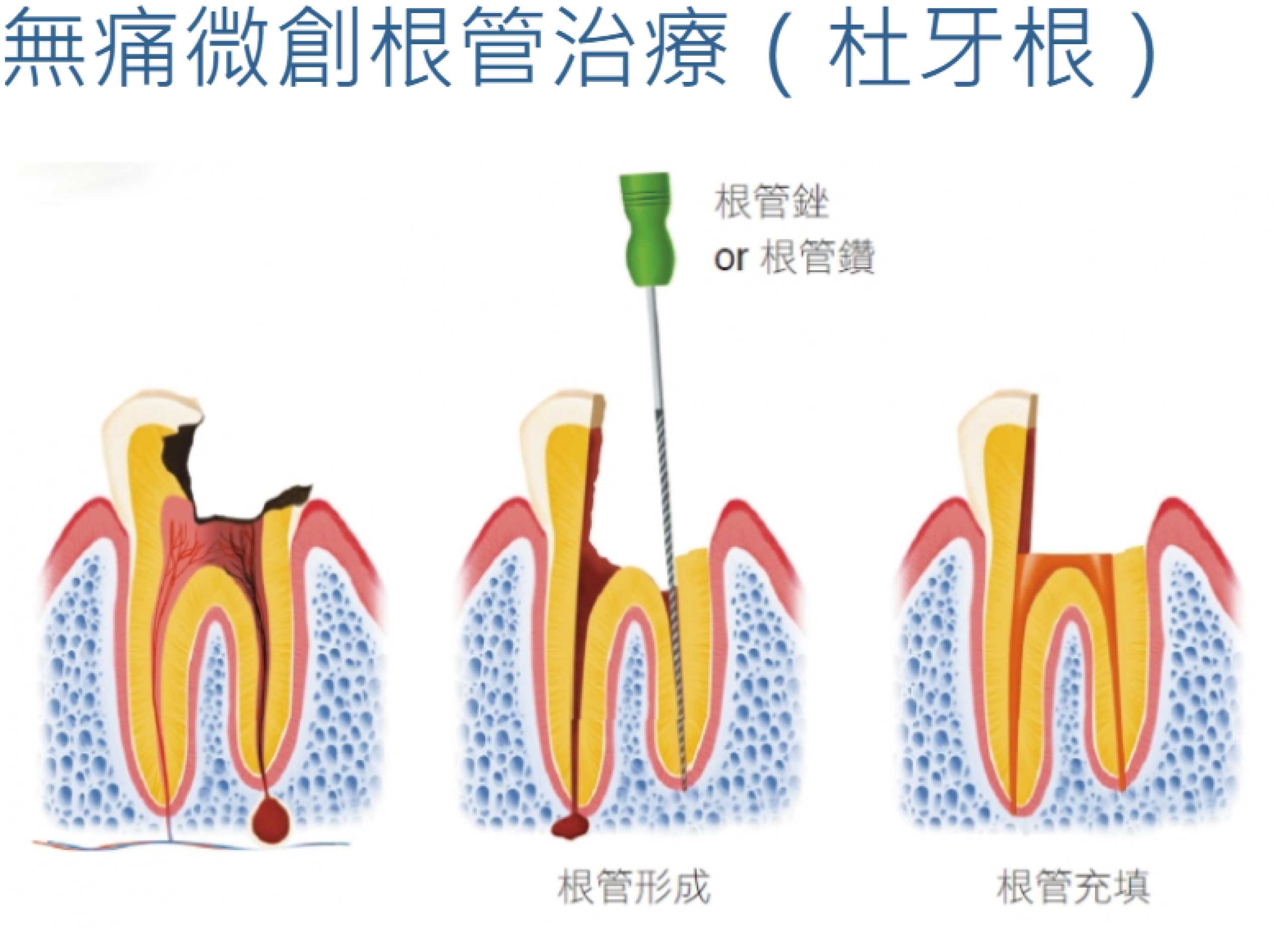 照片23_画板 1.jpg