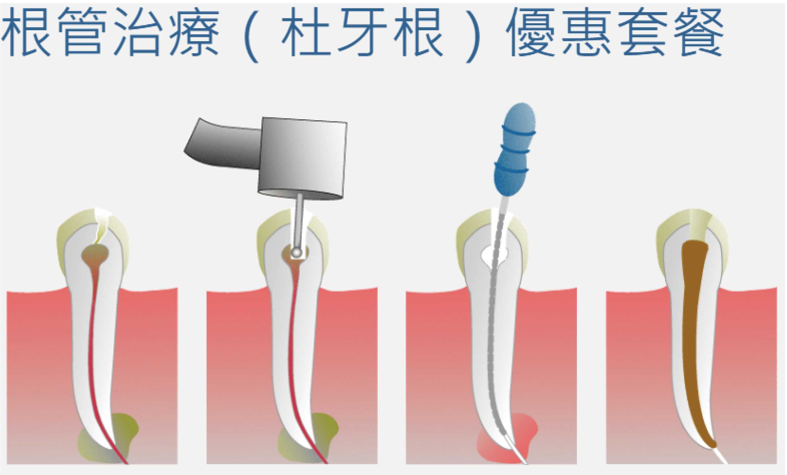照片25_画板 1.jpg