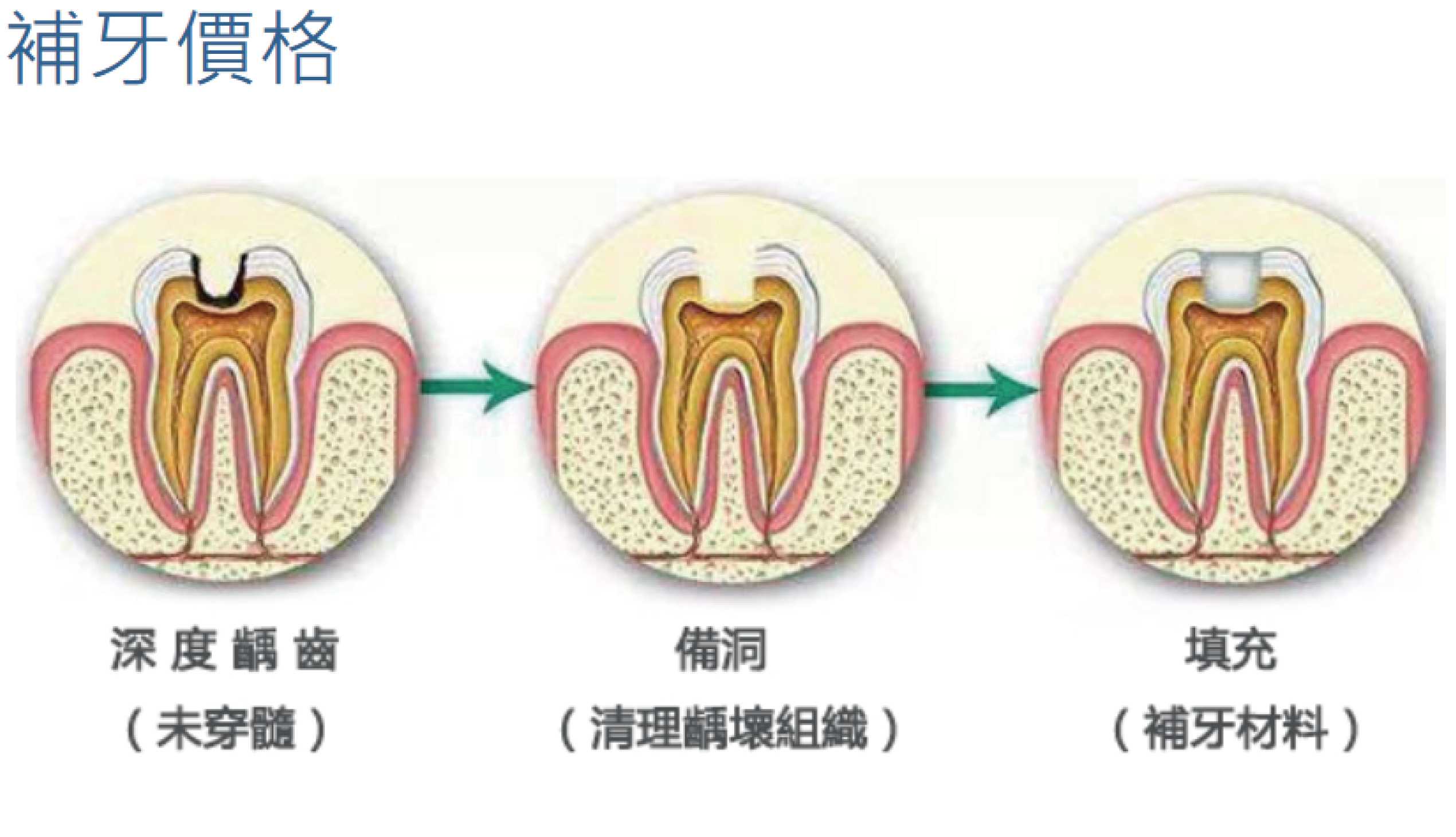 照片35_画板 1.jpg