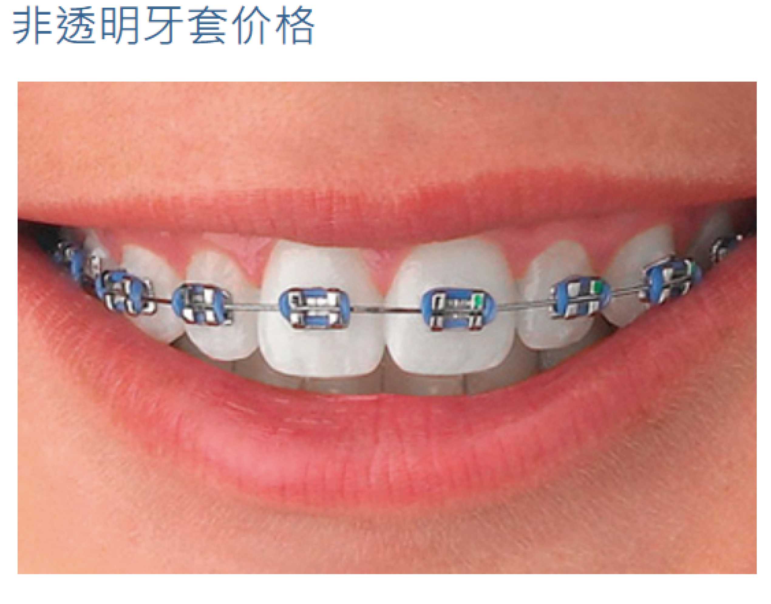 照片20_画板 1.jpg