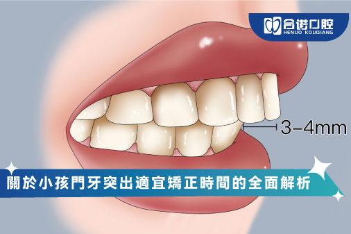 關於小孩門牙突出適宜矯正時間的全面解析