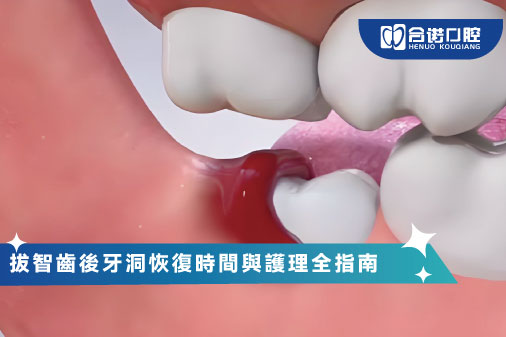 拔智齒後牙洞恢復時間與護理全指南