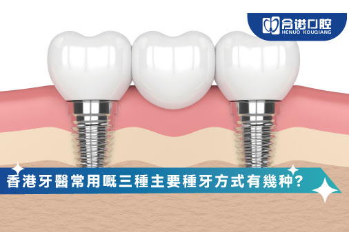 香港牙醫常用嘅三種主要種牙方式有幾种？