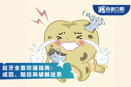 ​蛀牙（齲齒）全面防護指南：成因、階段與破解迷思