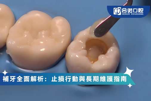 ​補牙全面解析：止損行動與長期維護指南