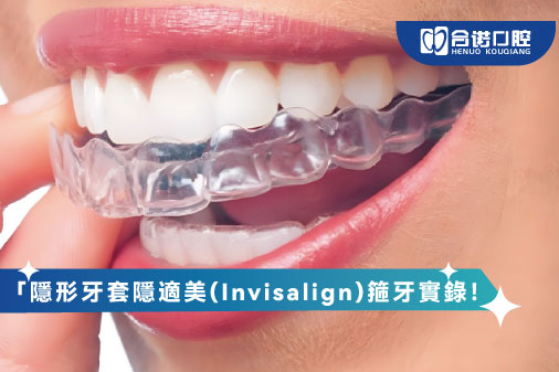 「隱形牙套隱適美(Invisalign)箍牙實錄！$65,000名牌定$35,000平價貨？醫生爆：效果差在呢步！