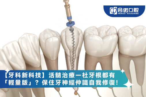 【牙科新科技】活髓治療—杜牙根都有「輕量版」？保住牙神經仲識自我修復！