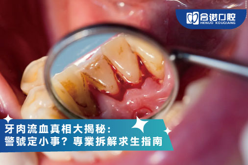 牙肉流血真相大揭秘：警號定小事？專業拆解求生指南