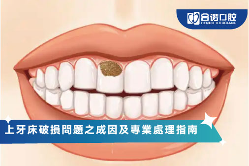 ​上牙床破損問題之成因及專業處理指南
