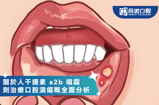 關於人干擾素 a2b 噴霧劑治療口腔潰瘍嘅全面分析
