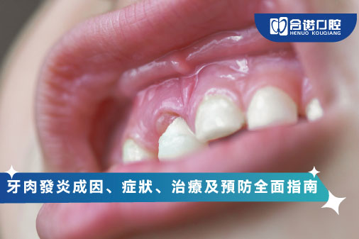 ​牙肉發炎成因、症狀、治療及預防全面指南