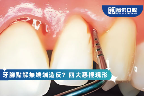 當牙齒發出SOS：明白牙根發炎嘅7个危險信號与黃金24小時處理法則