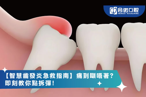 【智慧齒發炎急救指南】痛到瞓唔著？即刻教你點拆彈！