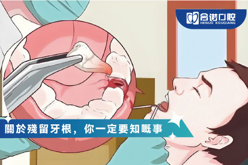 ​關於殘留牙根，你一定要知嘅事