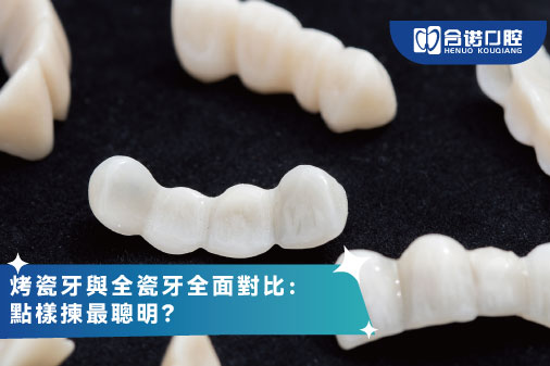 ​烤瓷牙與全瓷牙全面對比：點樣揀最聰明？