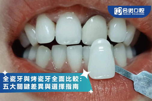 ​全瓷牙與烤瓷牙全面比較：五大關鍵差異與選擇指南