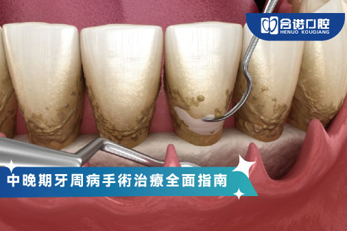 中晚期牙周病手術治療全面指南