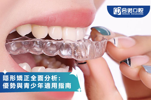 隱形矯正全面分析：優勢與青少年適用指南
