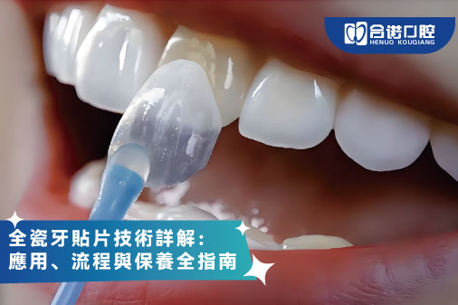全瓷牙貼片技術詳解：應用、流程與保養全指南
