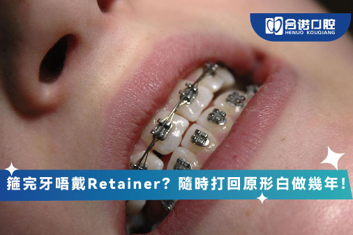 箍完牙唔戴Retainer？隨時打回原形白做幾年！