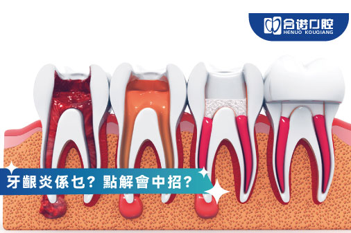 牙瘡係乜？三類怪獸大起底！