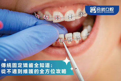 传统固定矫齿全知道：从不适到维护的全方位攻略