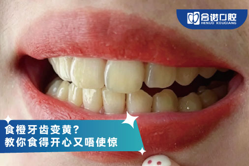 食橙牙齿变黄？ 教你食得开心又唔使惊