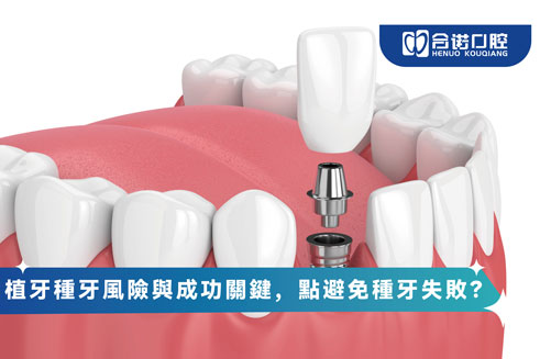 種牙風險與成功關鍵，點避免種牙失敗？
