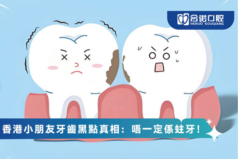 香港小朋友牙齒黑點真相：唔一定係蛀牙！