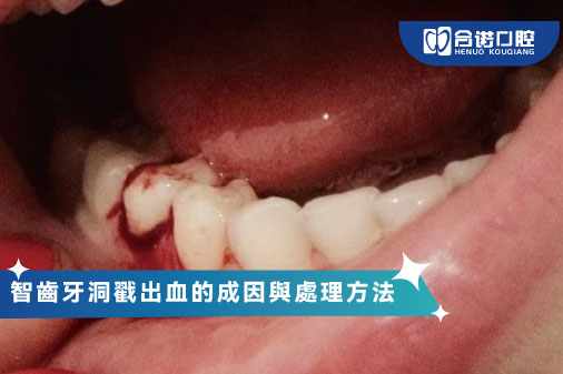 智齒牙洞戳出血的成因與處理方法