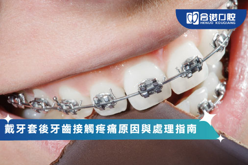 戴牙套後牙齒接觸疼痛原因與處理指南
