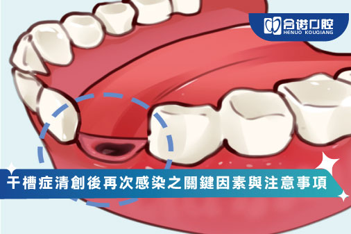 干槽症清創後再次感染之關鍵因素與注意事項