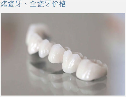 烤瓷牙全瓷牙
